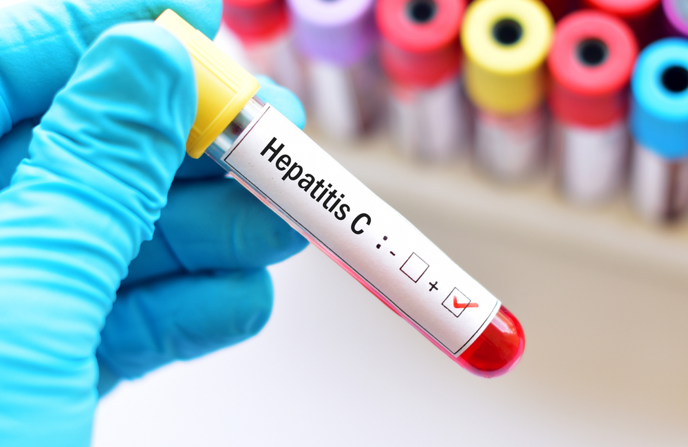 hepatitis-c.png
